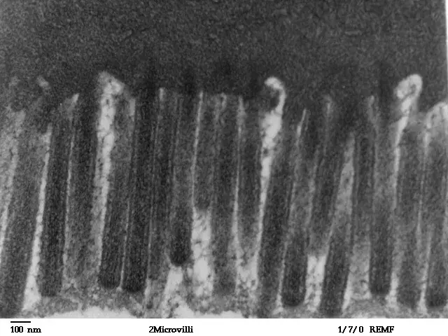 Human jejunum microvilli 2 - TEM